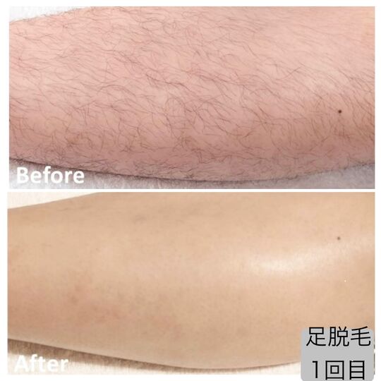 画像2191