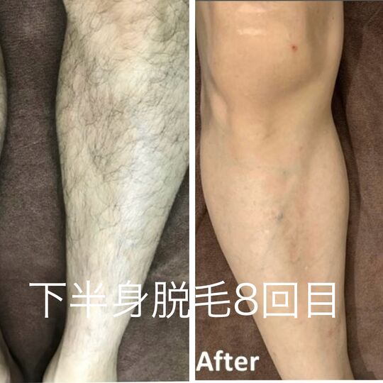 画像2193