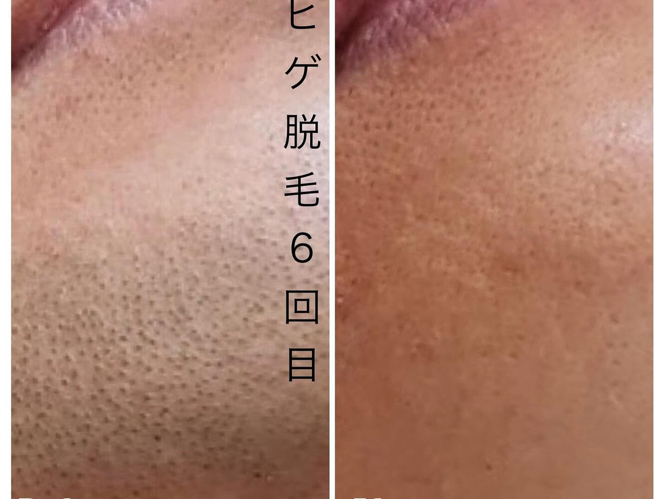 画像2263