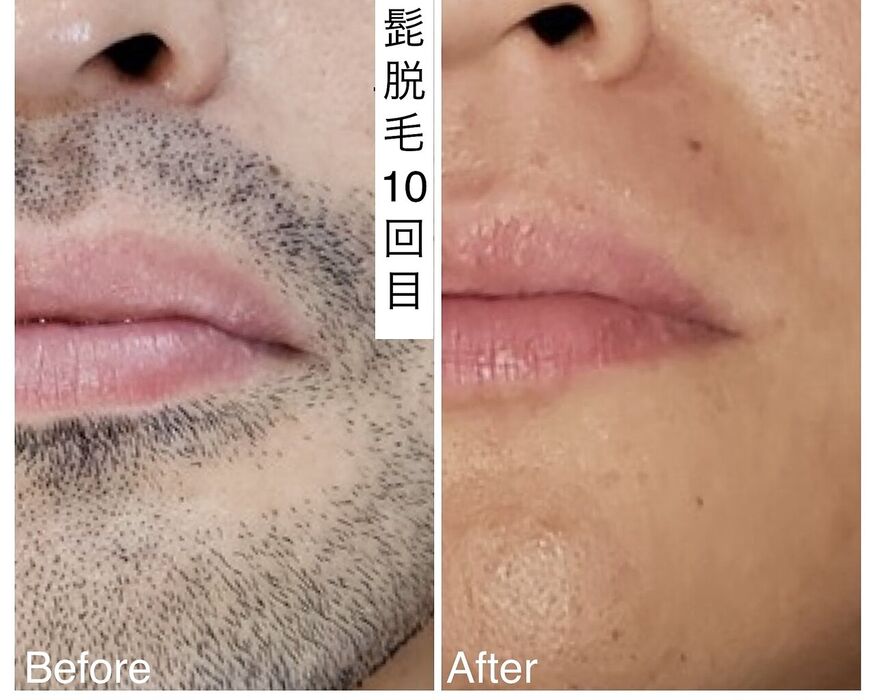 画像2379